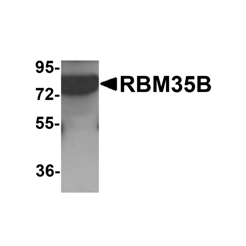 ProSci 6187 RBM35B Antibody