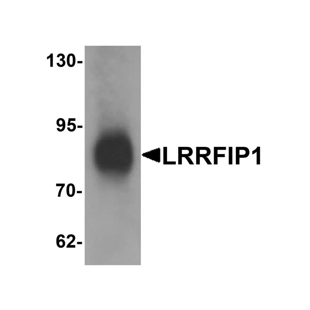 ProSci 6219 LRRFIP1 Antibody