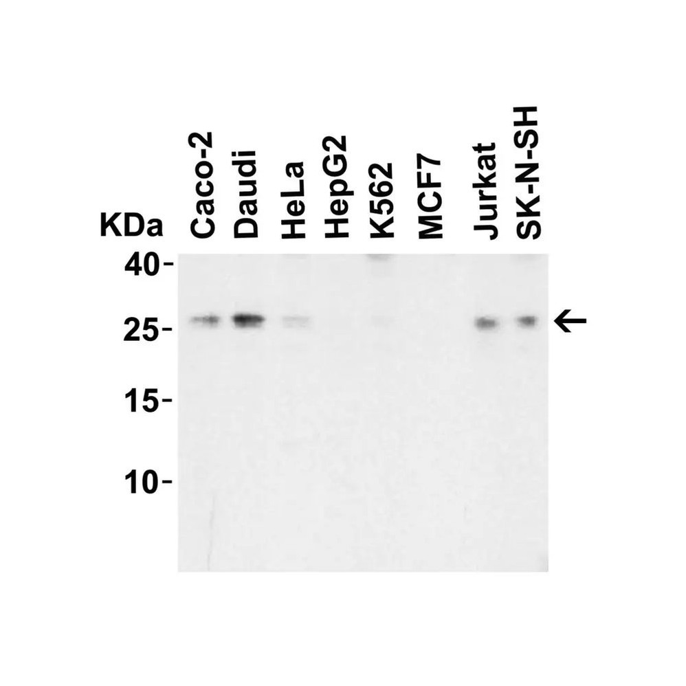 ProSci 6245 LIF Antibody