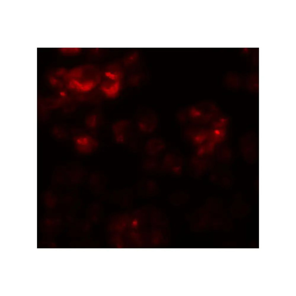 ProSci 6257 DYRK2 Antibody