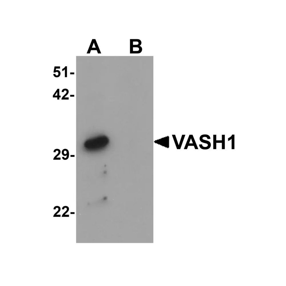 ProSci 6325 VASH1 Antibody