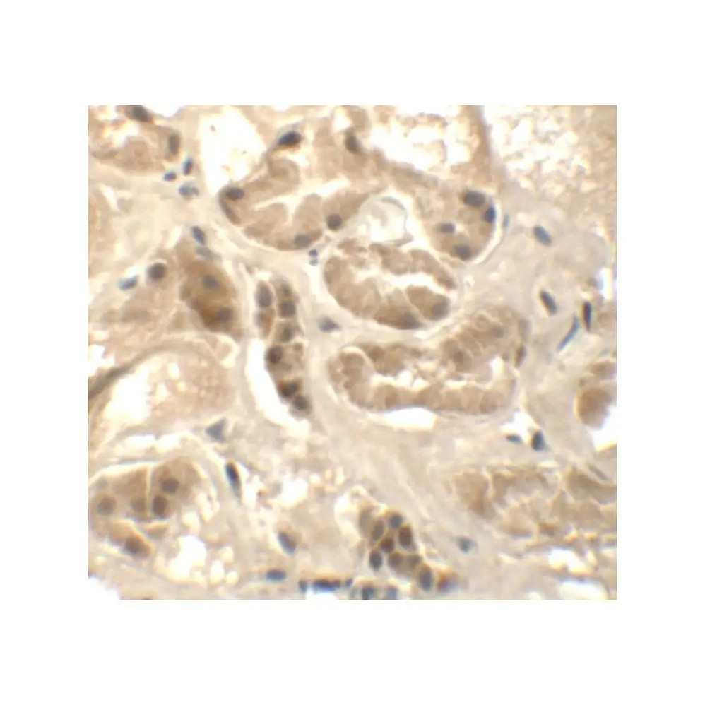 ProSci 6389 ATAD3B Antibody