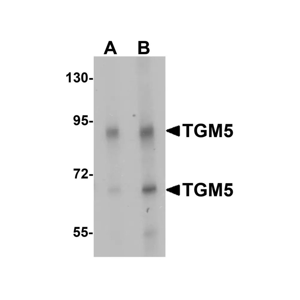 ProSci 6537 TGM5 Antibody