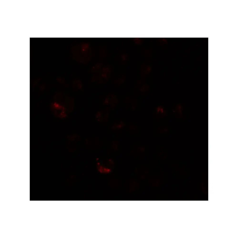 ProSci 6567 PRICKLE4 Antibody