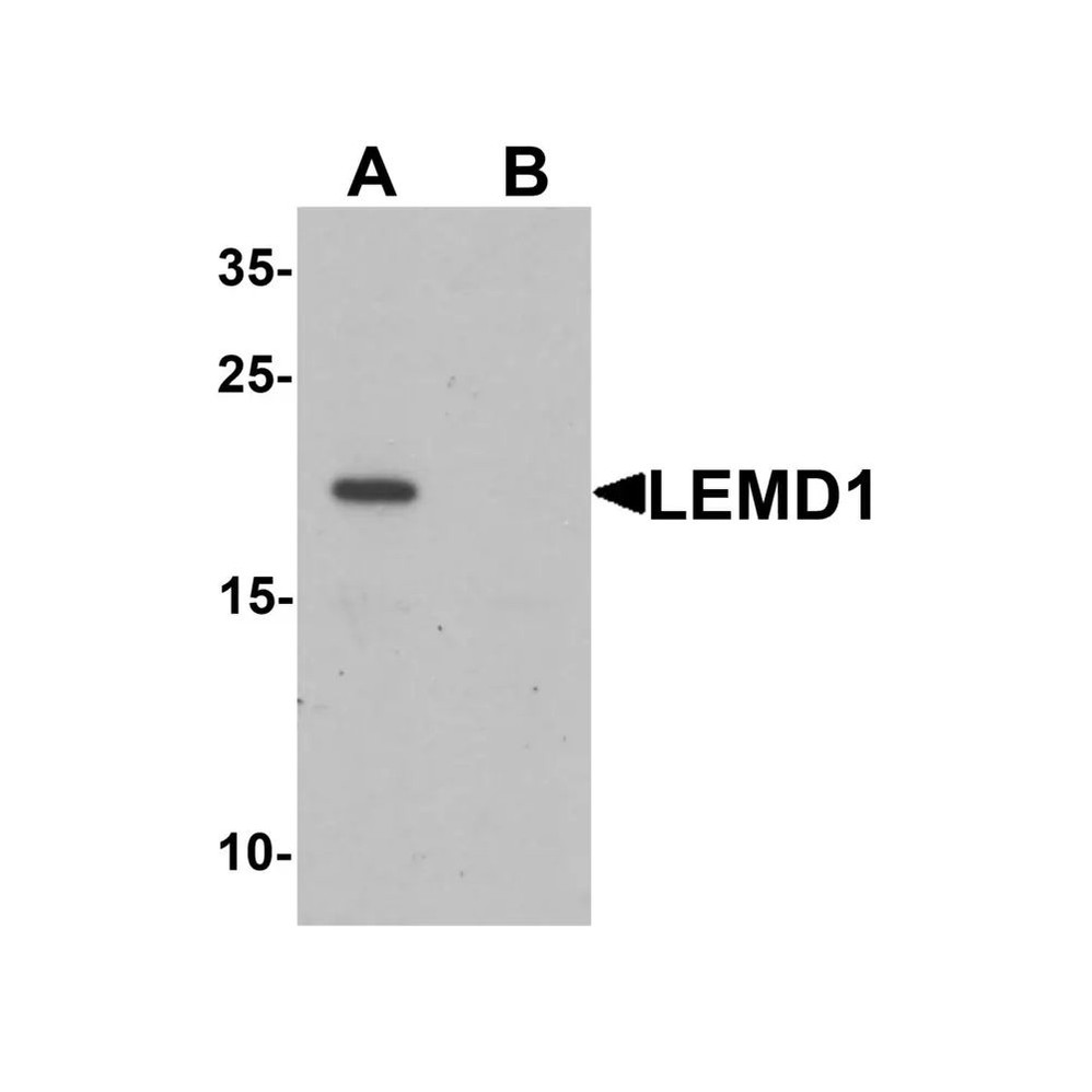 ProSci 6599 LEMD1 Antibody