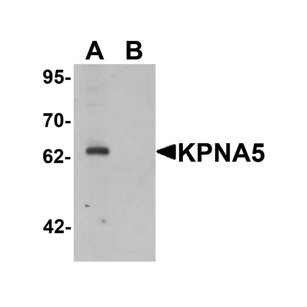 ProSci 6655 KPNA5 Antibody