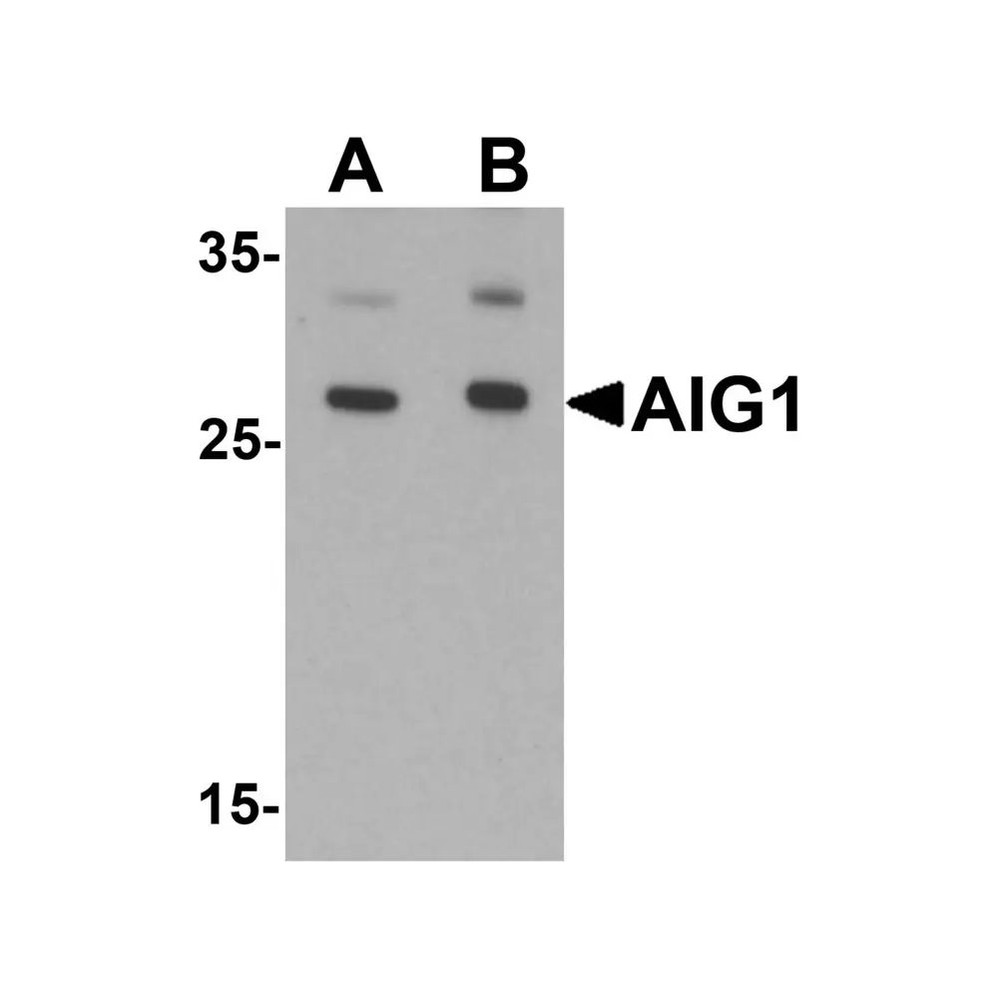 ProSci 6785 AIG1 Antibody