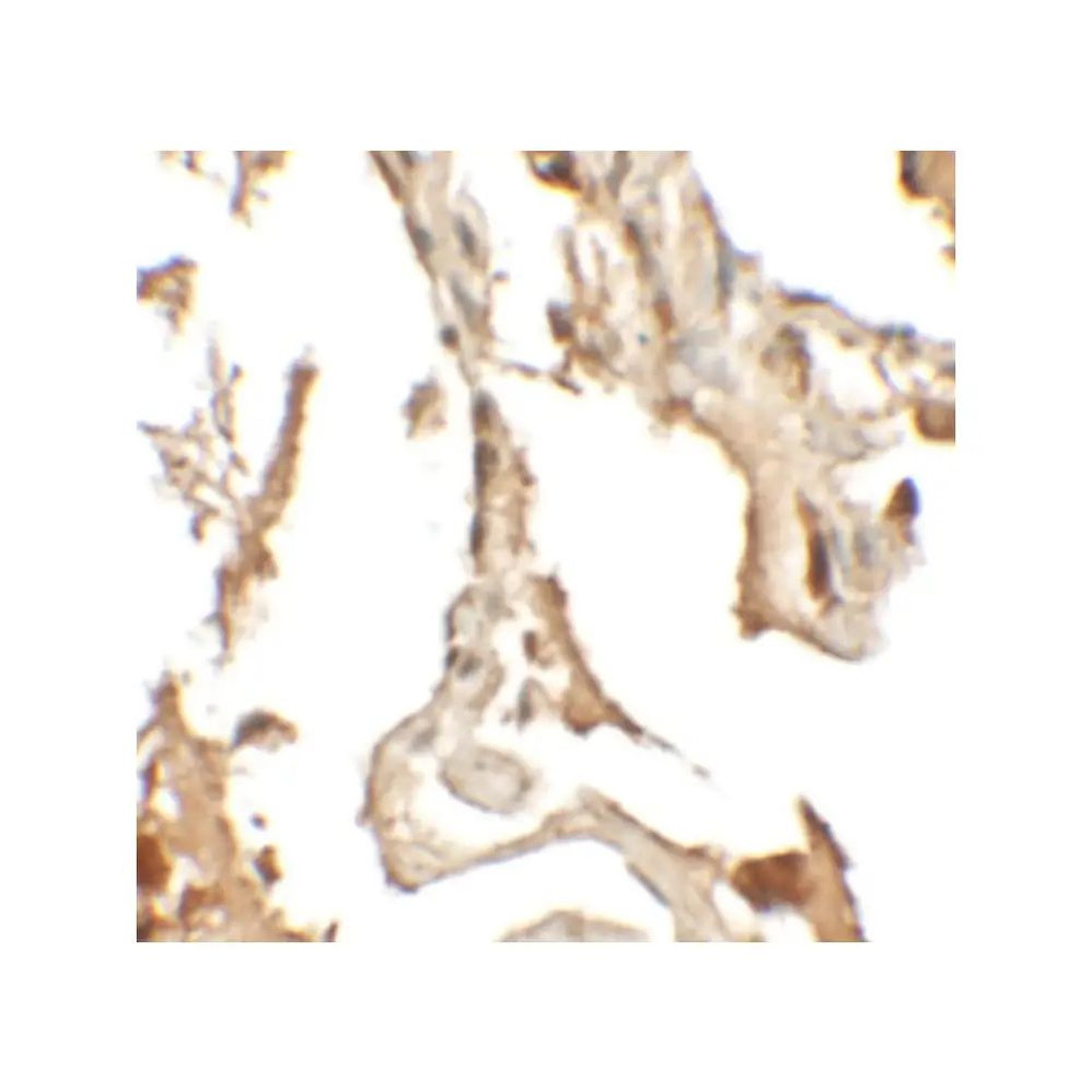 ProSci 6799 RLP2 Antibody