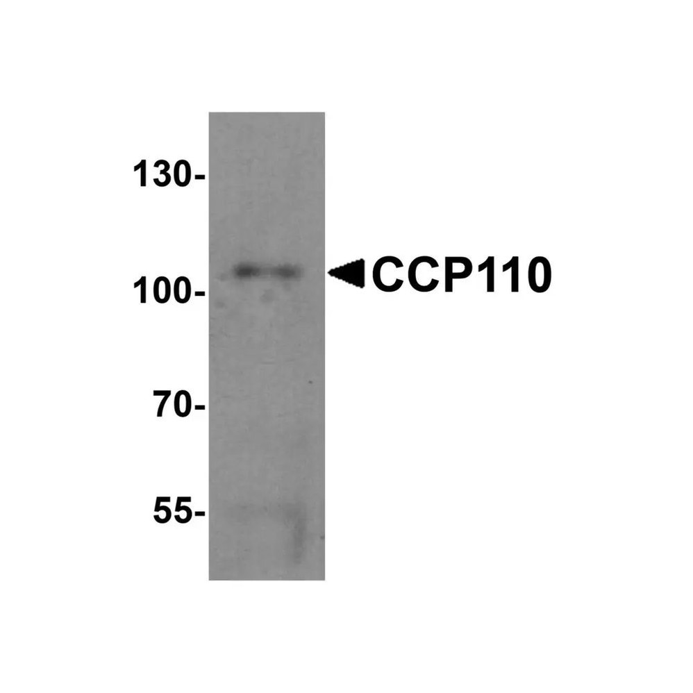 ProSci 6825 CCP110 Antibody