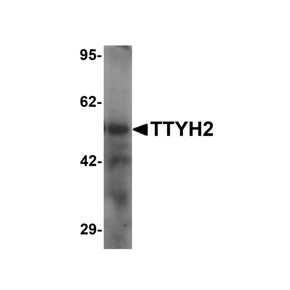 ProSci 6885 TTYH2 Antibody
