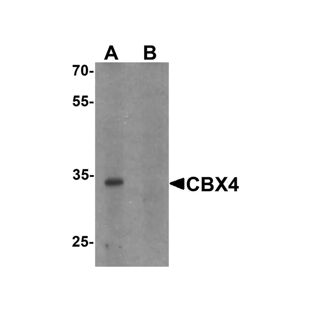 ProSci 7007 CBX4 Antibody