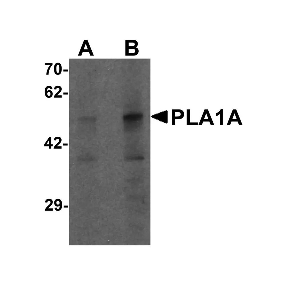 ProSci 7059 PLA1A Antibody