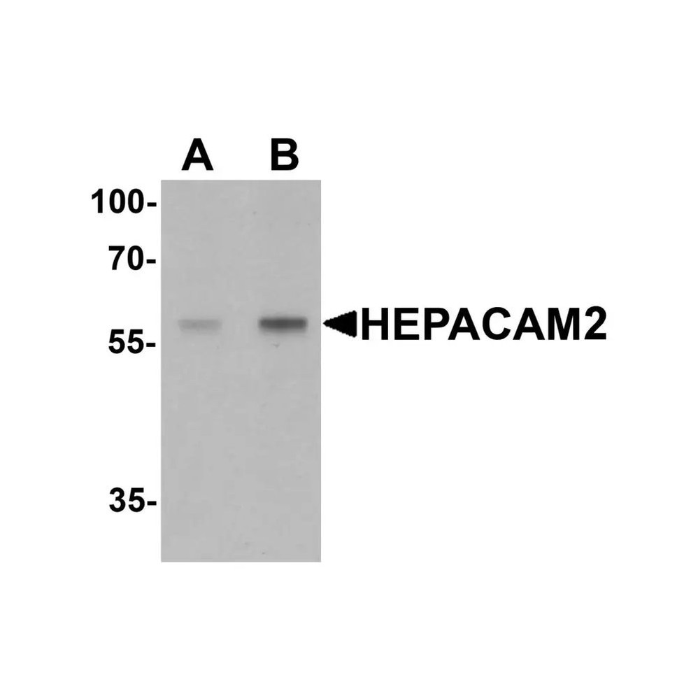 ProSci 7111 HEPACAM2 Antibody