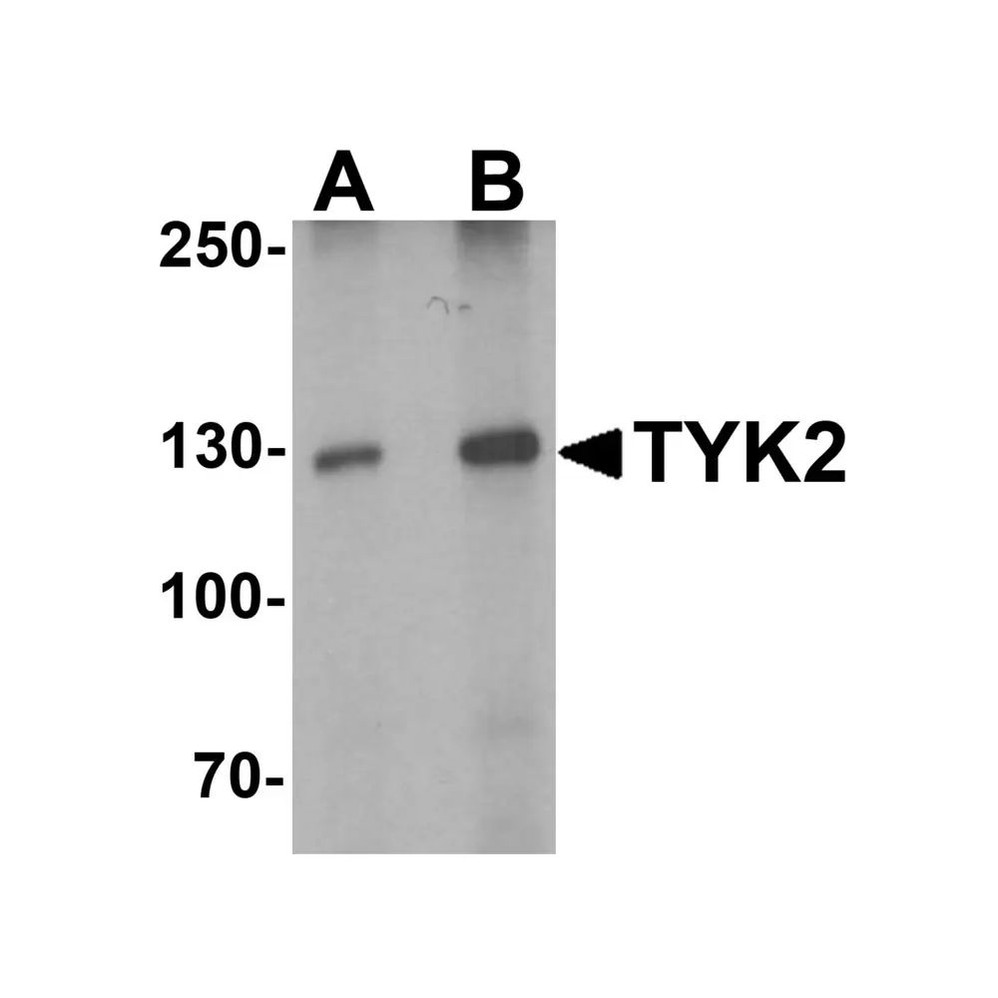 ProSci 7177 TYK2 Antibody