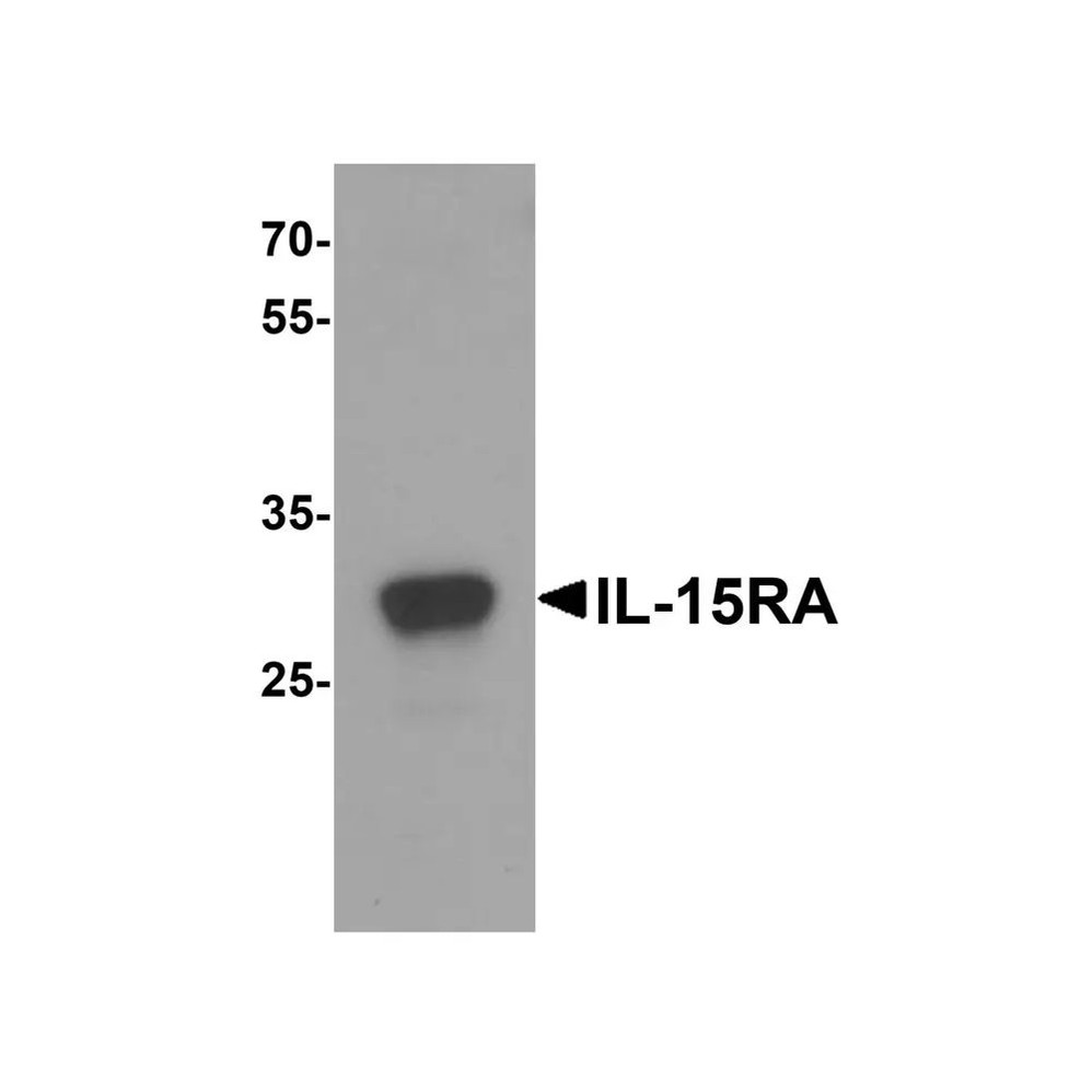 ProSci 7233 IL-15RA Antibody