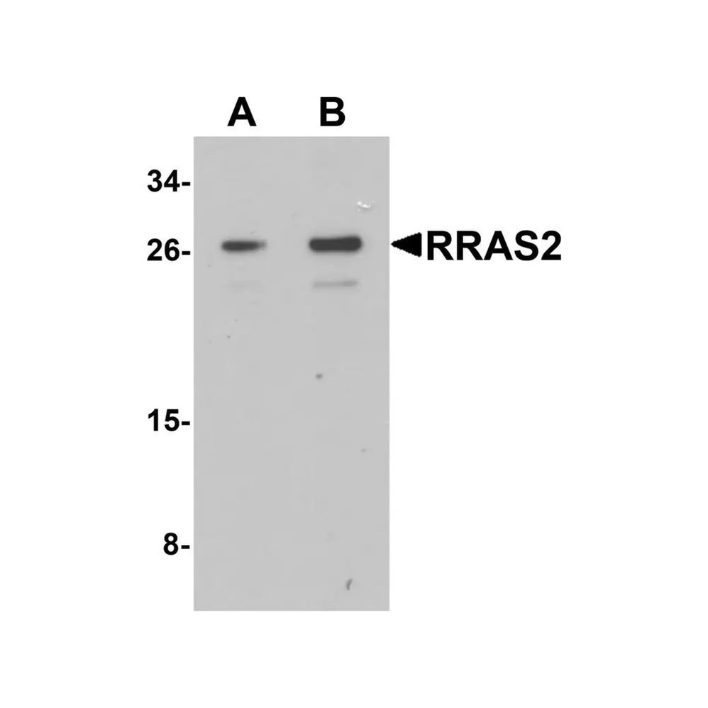 ProSci 7249 RRAS2 Antibody