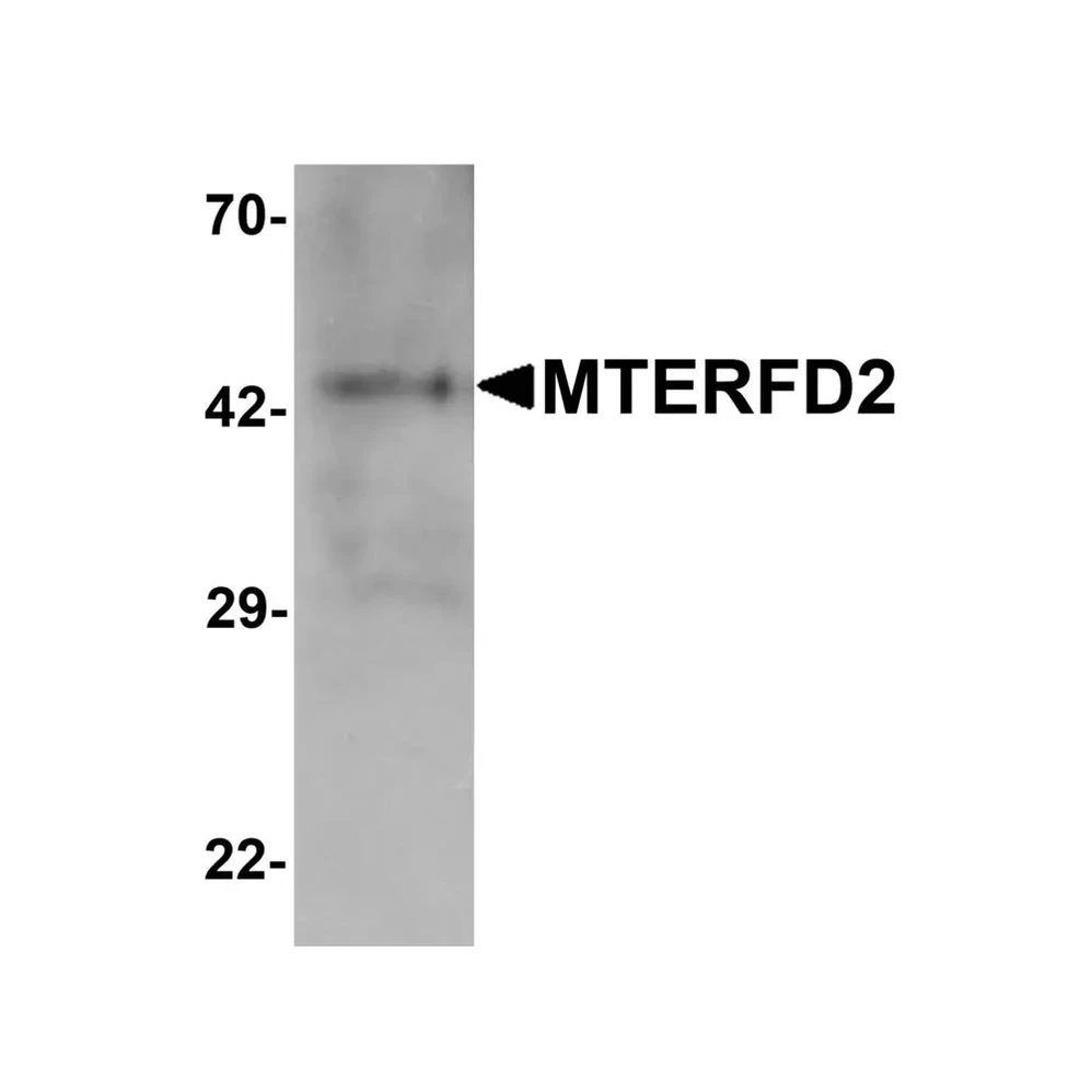 ProSci 7283 MTERFD2 Antibody