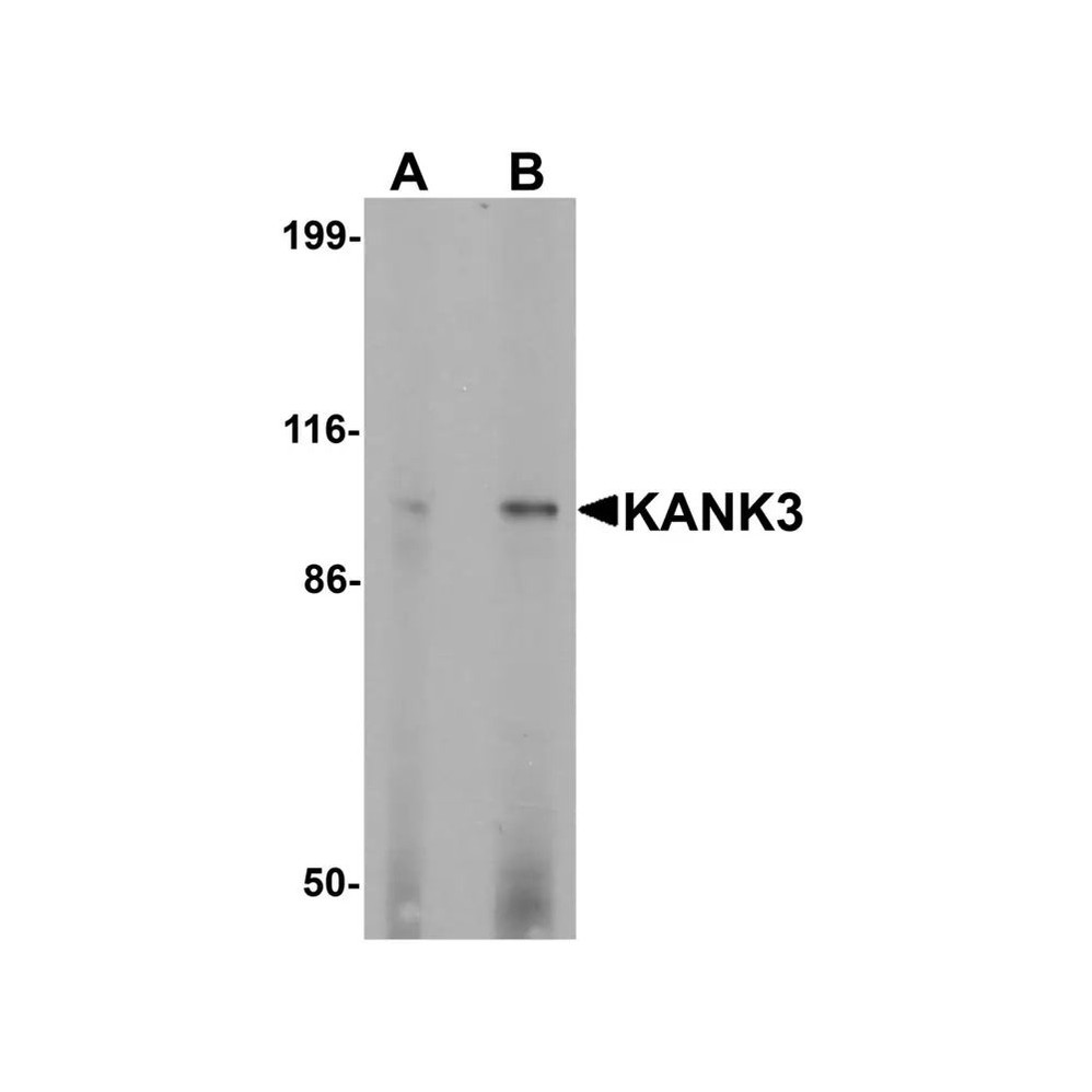 ProSci 7311 KANK3 Antibody