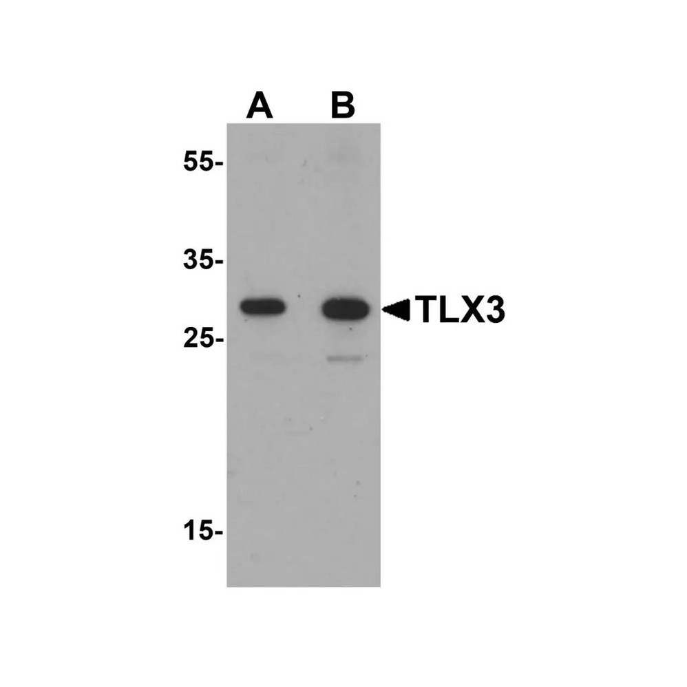 ProSci 7375 TLX3 Antibody