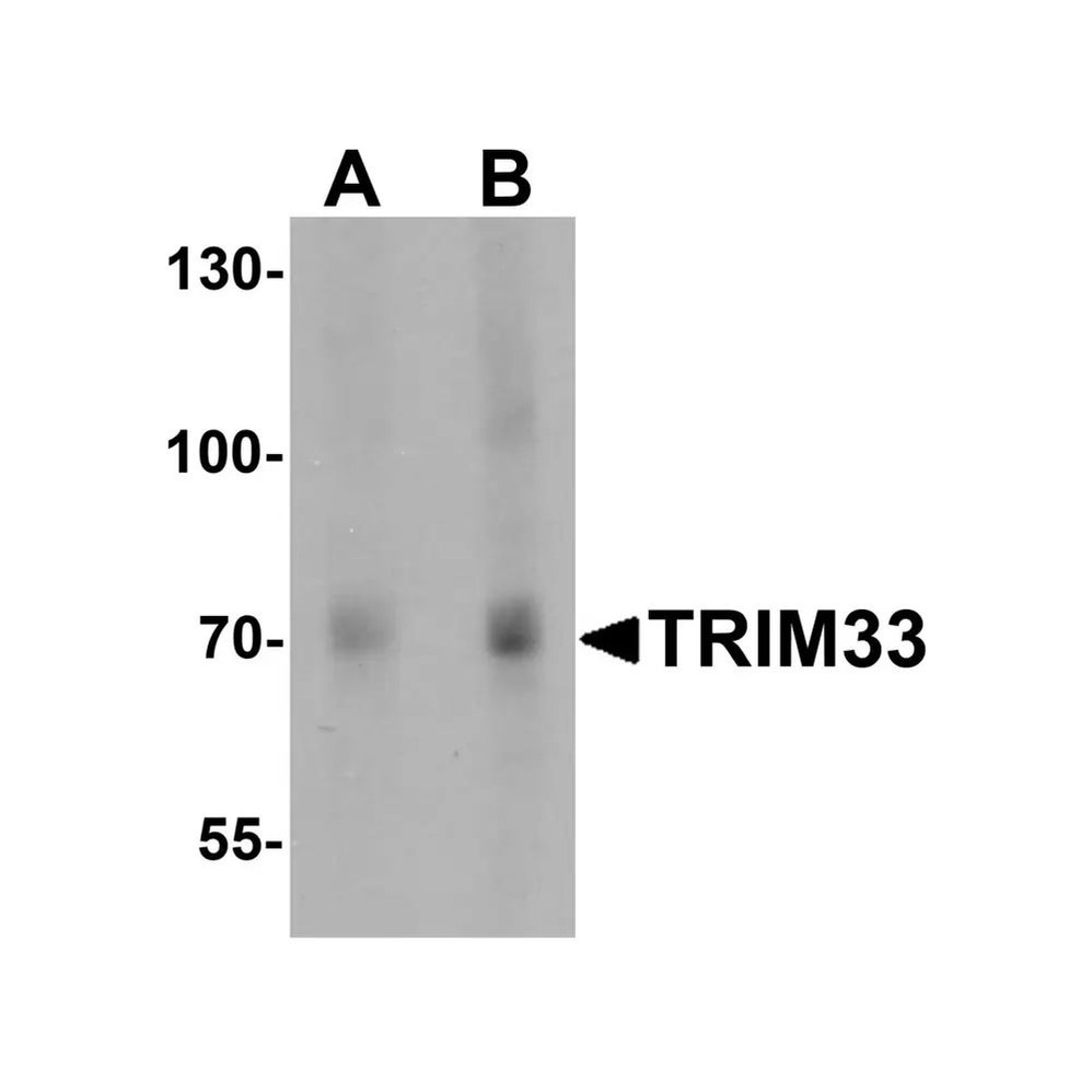 ProSci 7385 TRIM33 Antibody