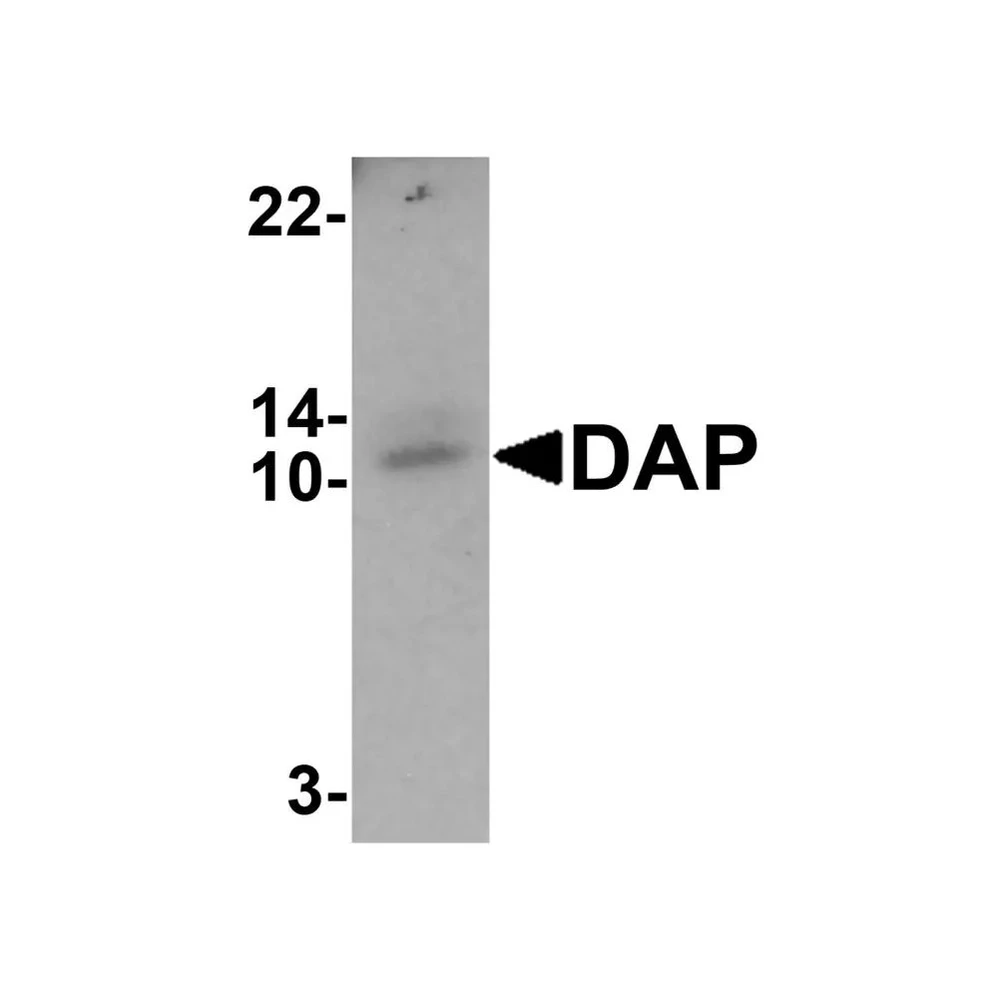 ProSci 7389 DAP Antibody