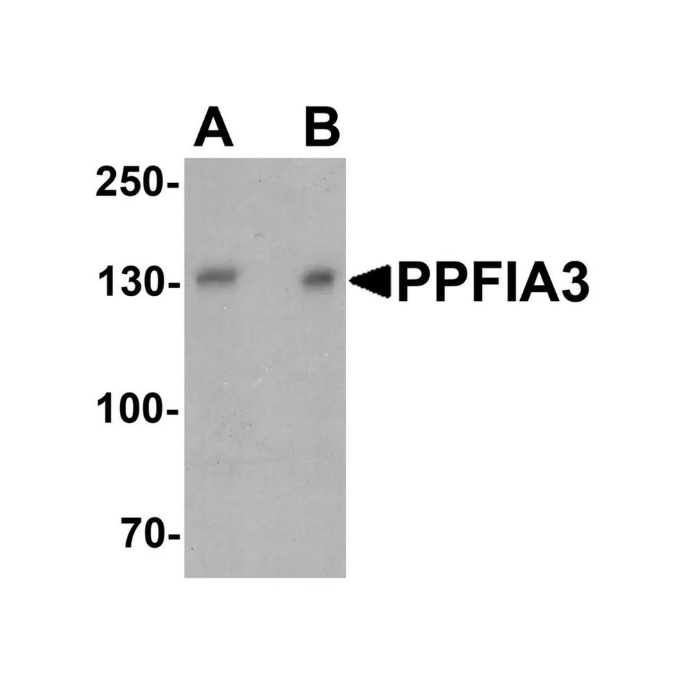 ProSci 7561 PPFIA3 Antibody