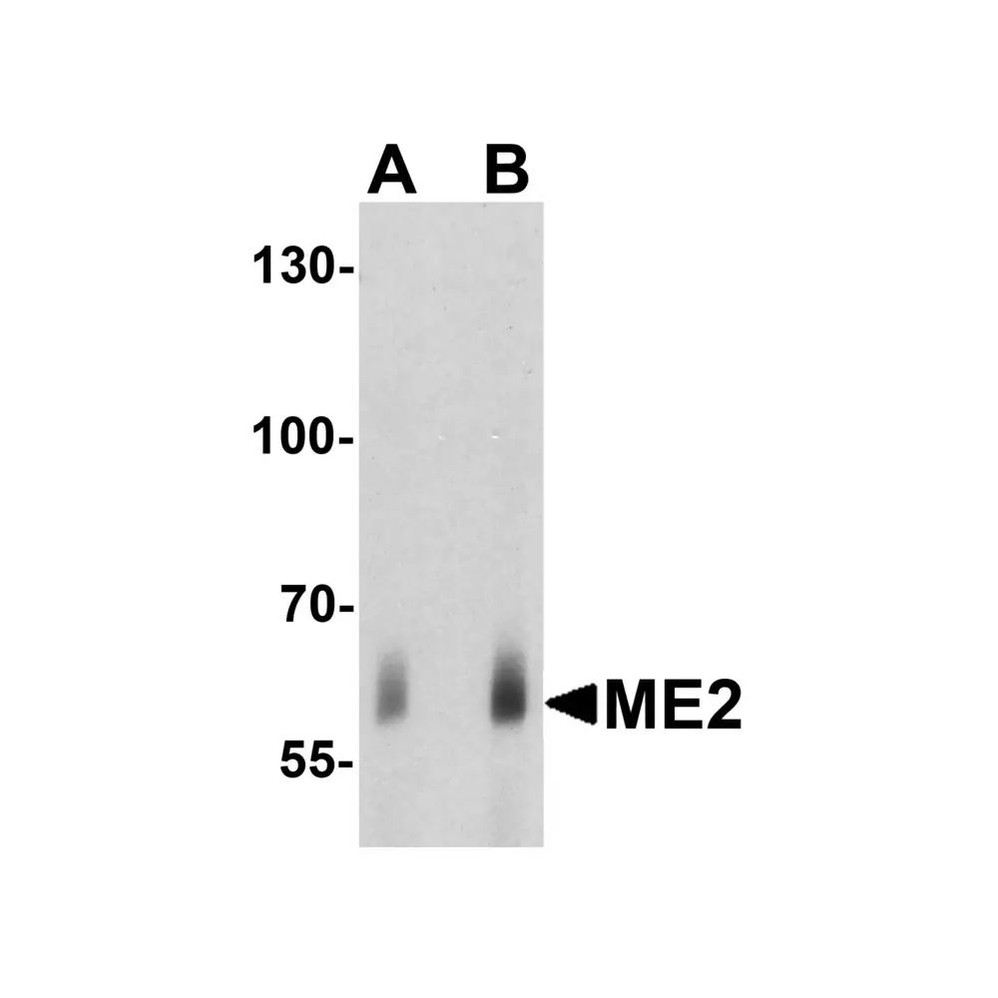 ProSci 7723 ME2 Antibody