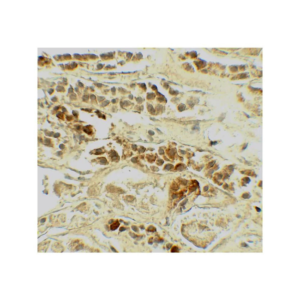 ProSci 7727 TERF2 Antibody