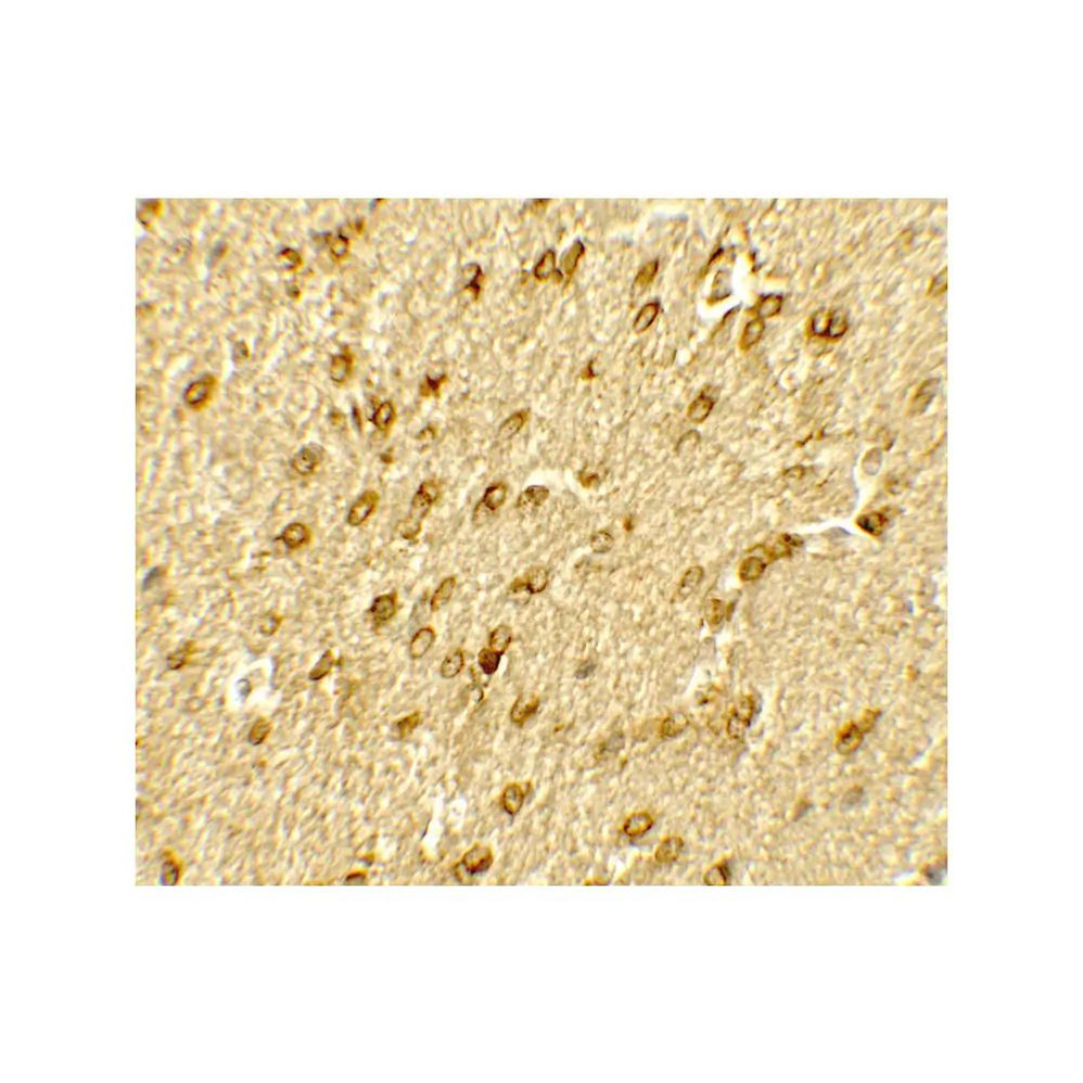 ProSci 7749 SMARCA4 Antibody