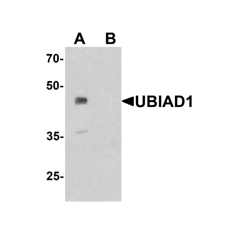 ProSci 7751 UBIAD1 Antibody