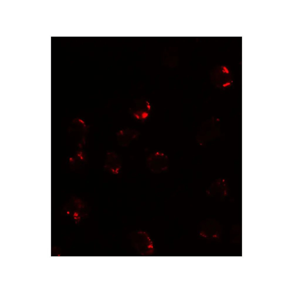 ProSci 7789 FKBP12 Antibody