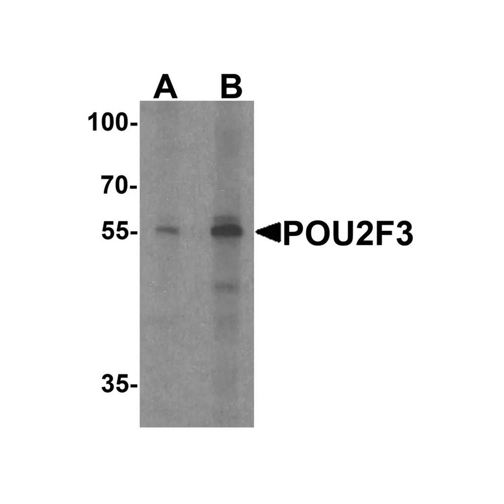 ProSci 7795 POU2F3 Antibody