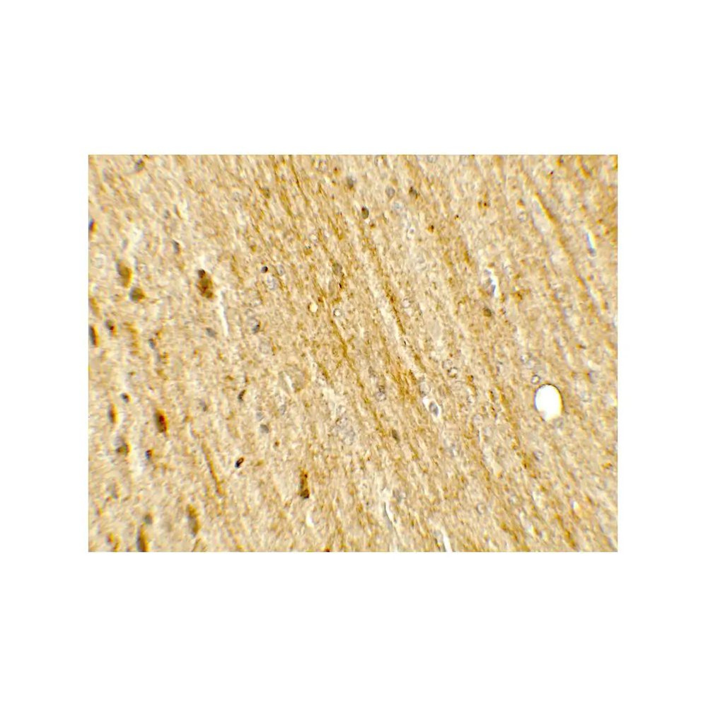 ProSci 7795 POU2F3 Antibody