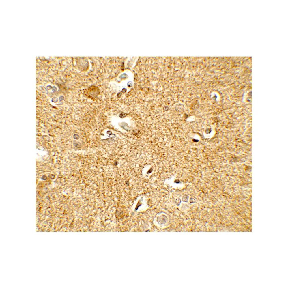 ProSci 7797 CRH Antibody