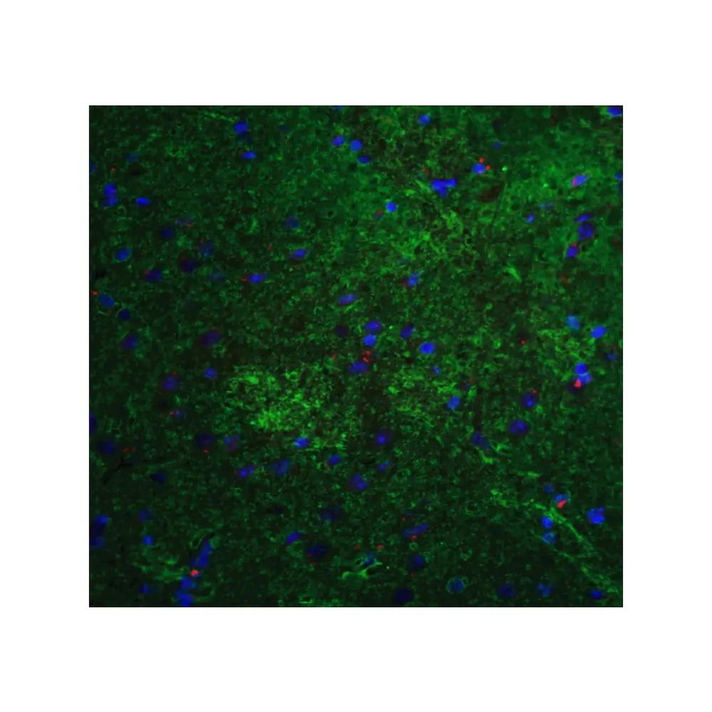ProSci 7863 MFN2 Antibody