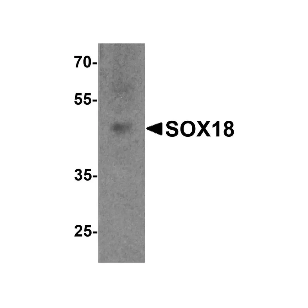 ProSci 7919 SOX18 Antibody