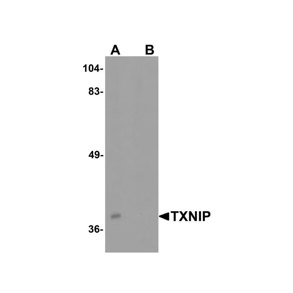 ProSci 7939 BATF3 Antibody