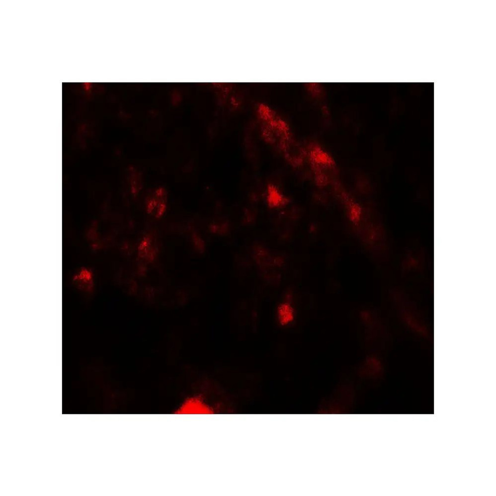 ProSci 7949 PIK3R4 Antibody