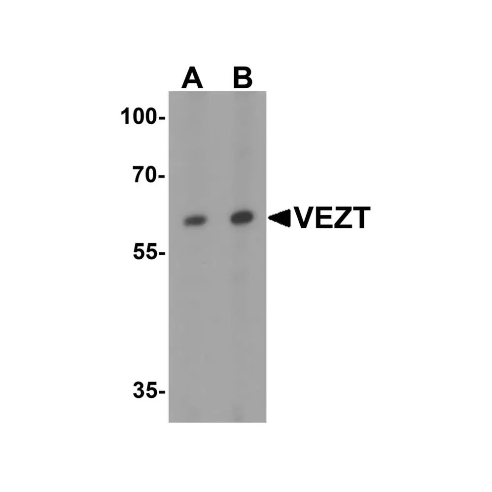 ProSci 7959 VEZT Antibody
