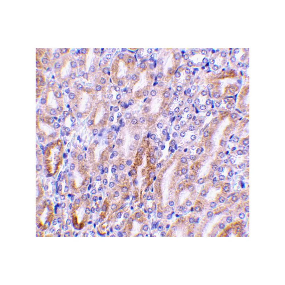 ProSci 2011 CAD Antibody