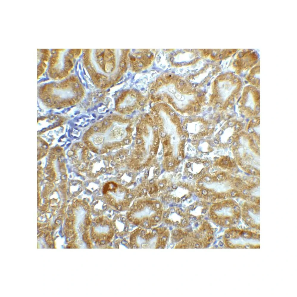 ProSci 2011 CAD Antibody