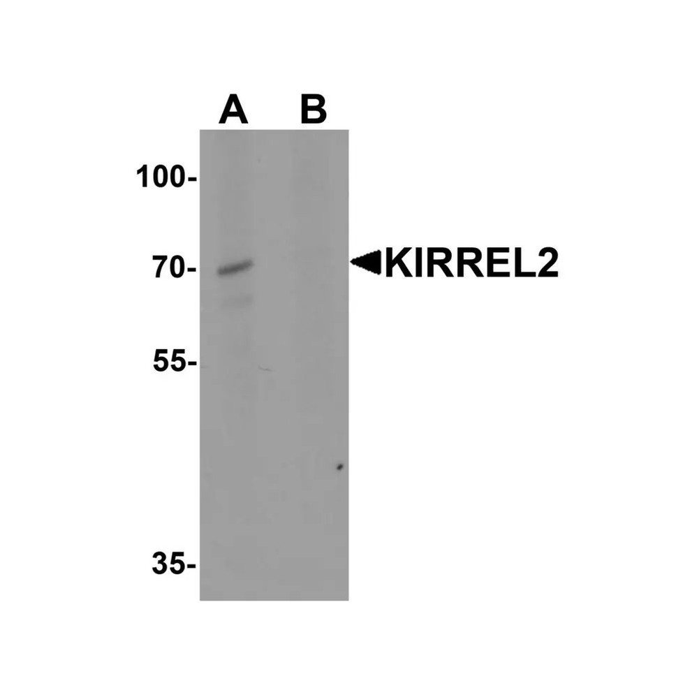 ProSci 7971 KIRREL2 Antibody