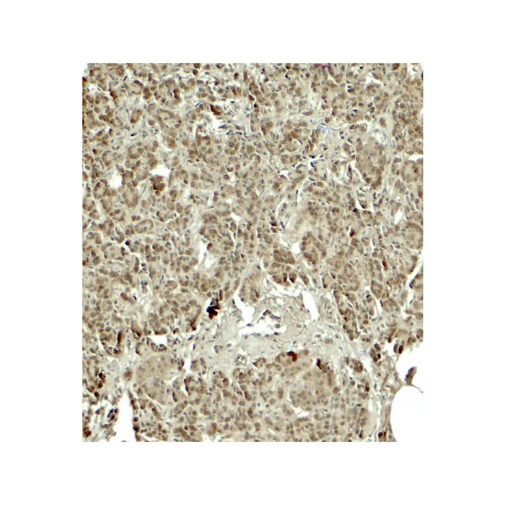 ProSci 7971 KIRREL2 Antibody