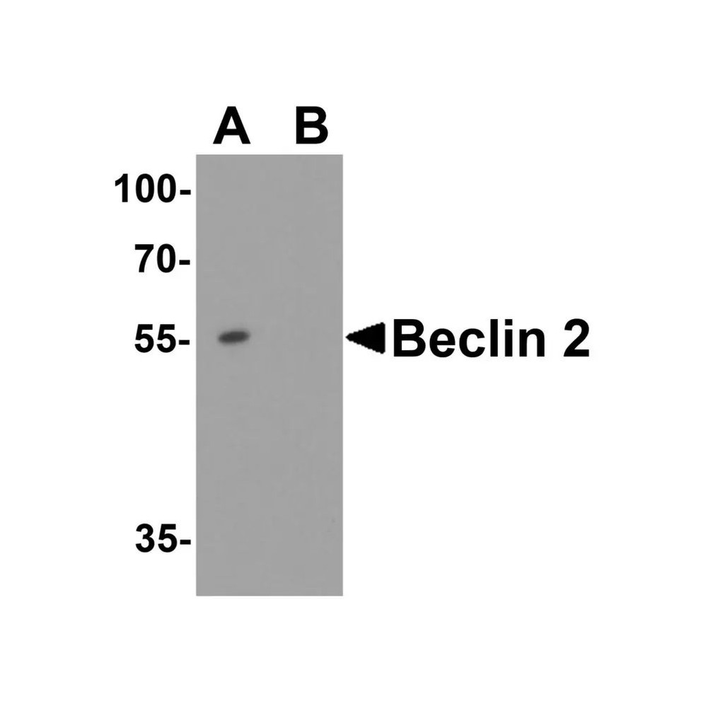ProSci 7991 WWC1 Antibody