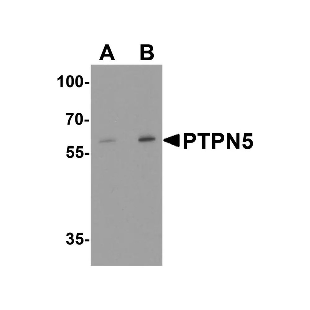 ProSci 8013 PTPN5 Antibody