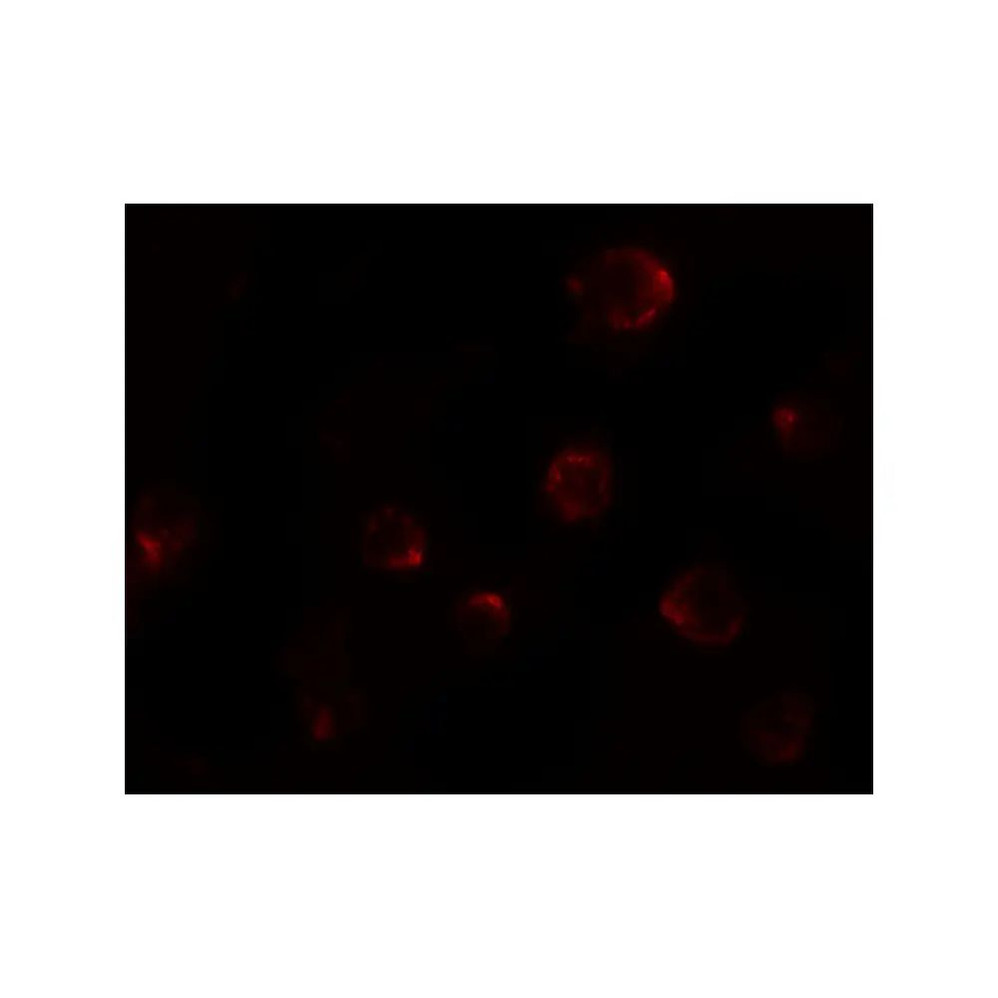 ProSci 8015 P2RX7 Antibody