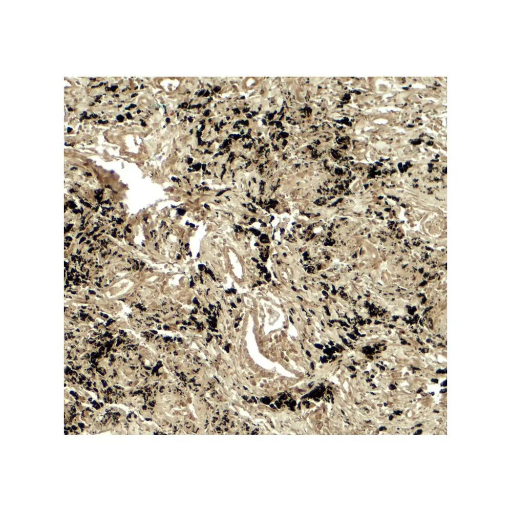 ProSci 8043 PPM1D Antibody