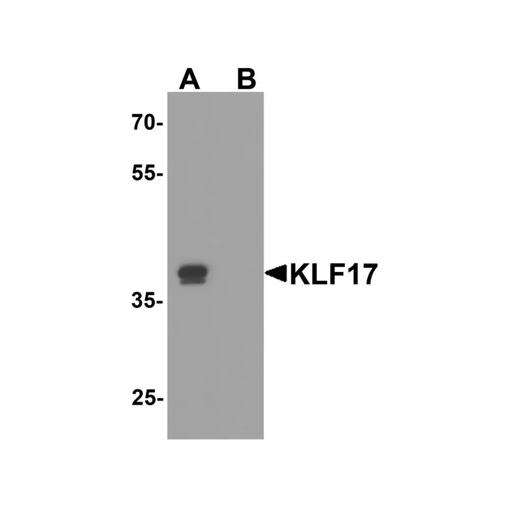 ProSci 8041 KLF17 Antibody