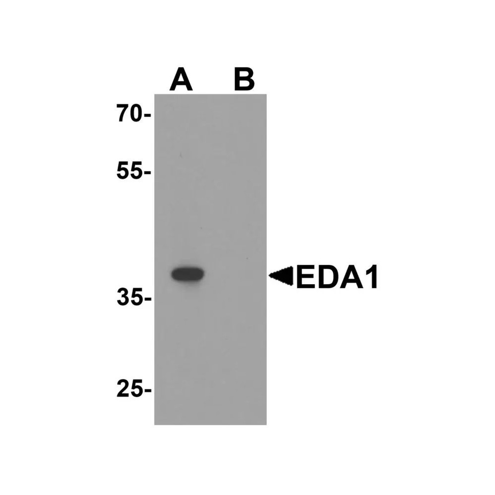 ProSci 8045 EDA1 Antibody