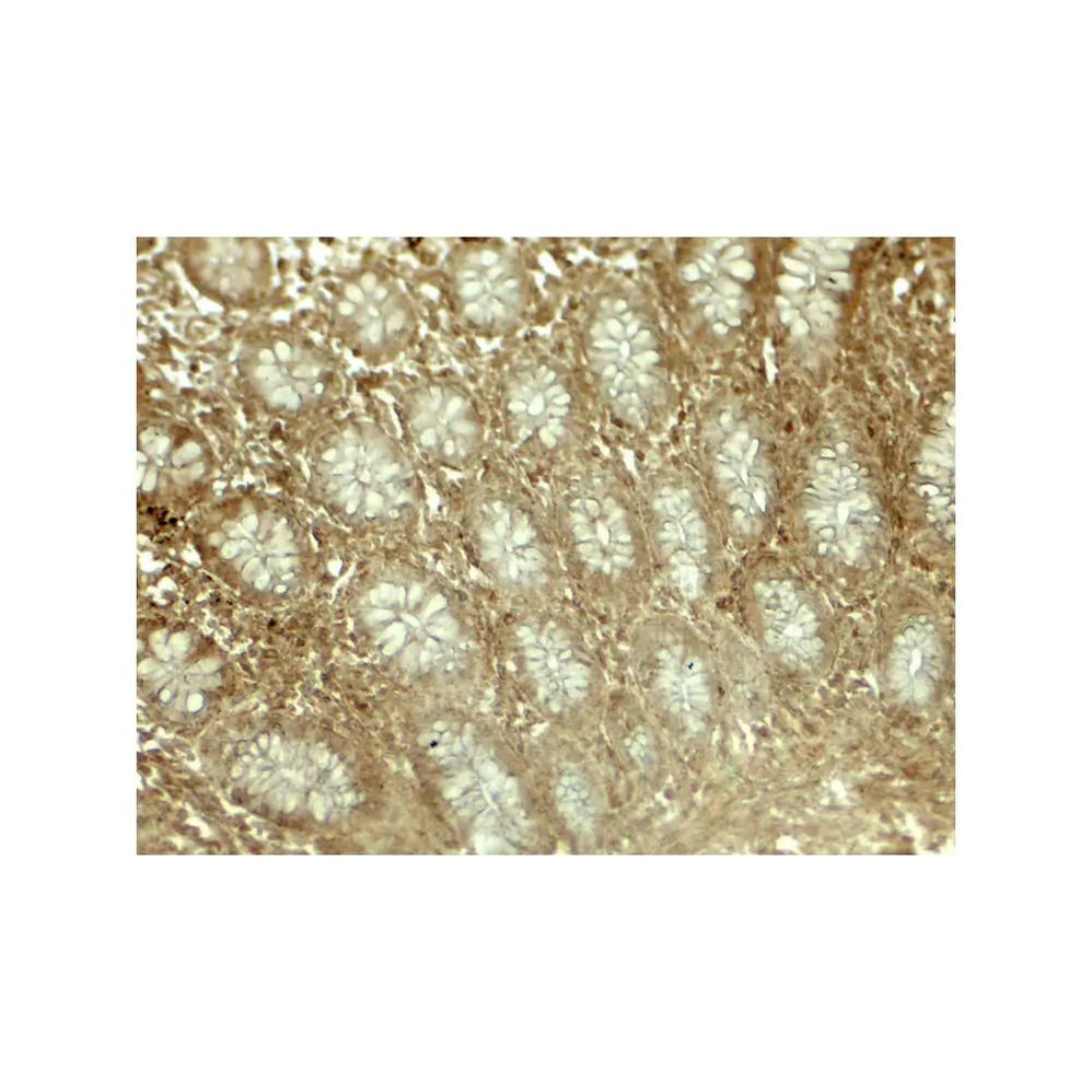 ProSci 8053 LIMA1 Antibody